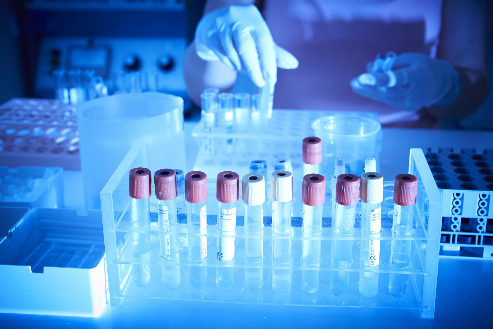 Ostravská CGB Laboratoř a.s. mění název, jsou z ní  EUC Laboratoře CGB a.s.