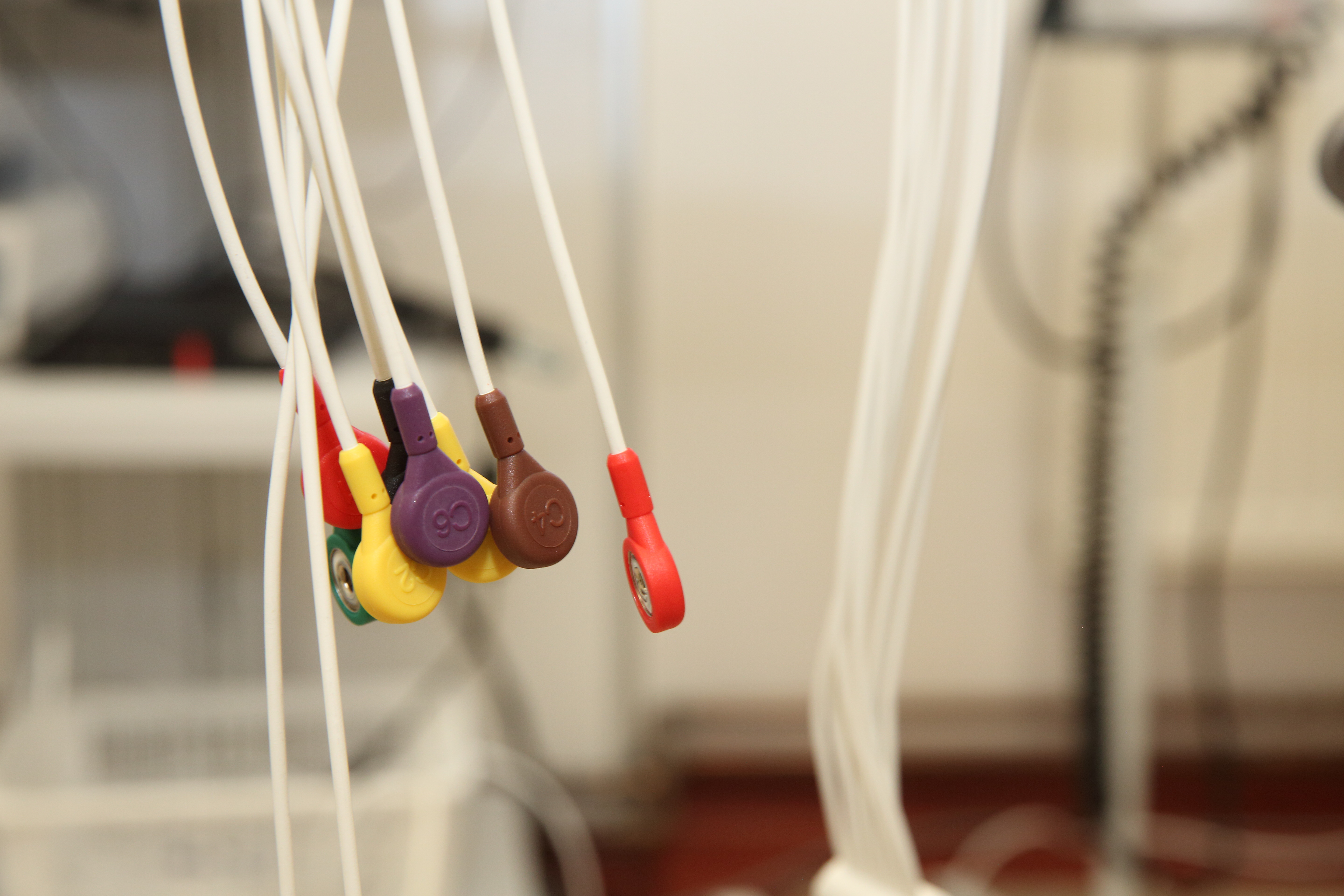 EKG – klidové a zátěžové. Proč a jak číst data a ukazatele?